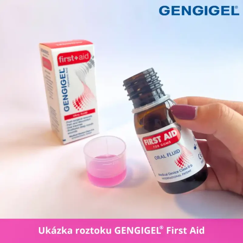 GENGIGEL First aid roztok na zánět dásní a hojení po extrakci zubu