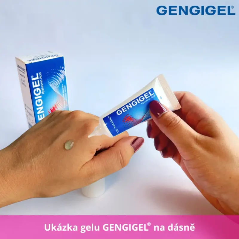 aplikace gengigel gel na dásně. Gel na zánět a krvácení dásní