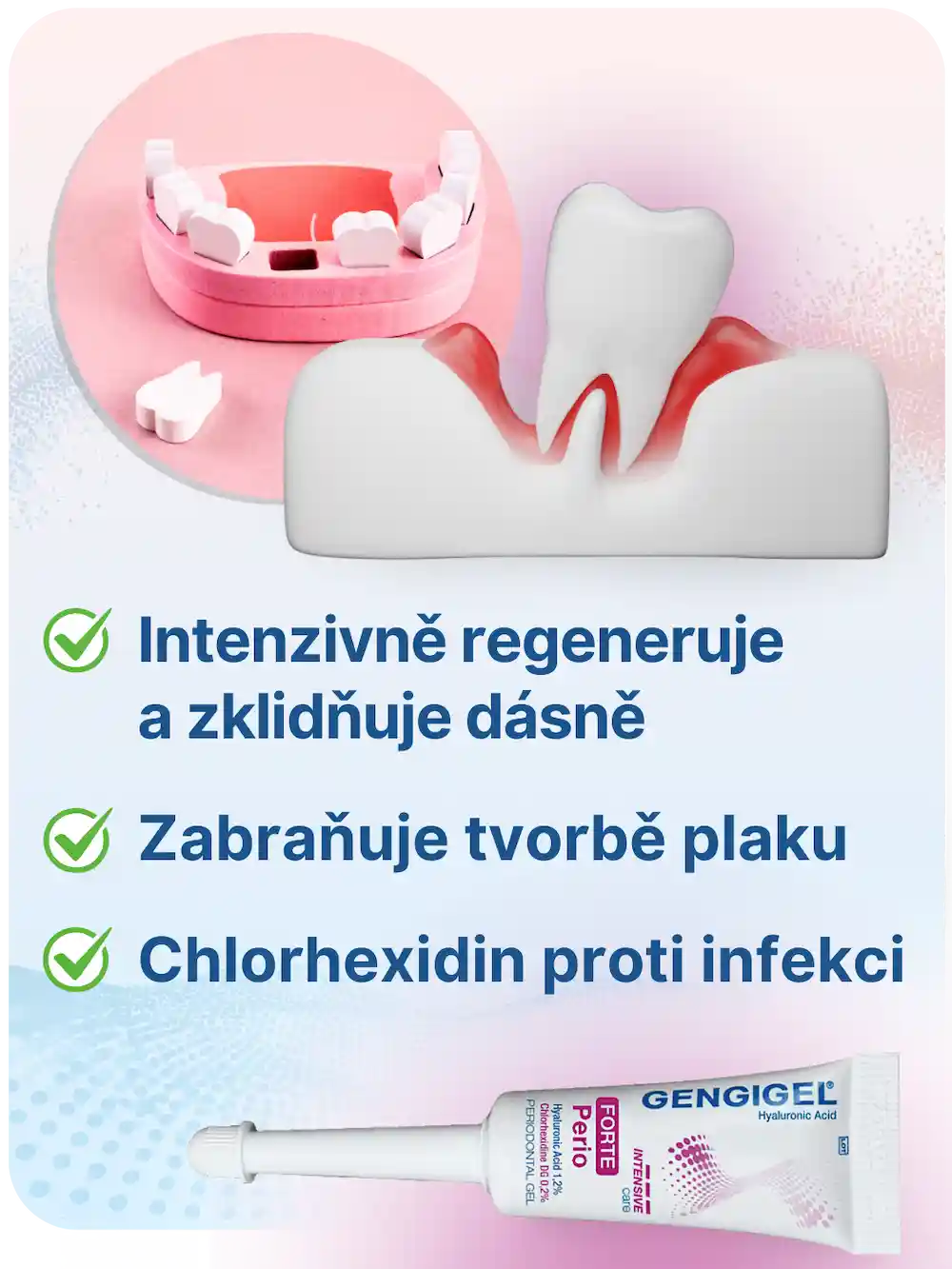 GENGIGEL® Forte – rychle zklidňuje zánět dásní